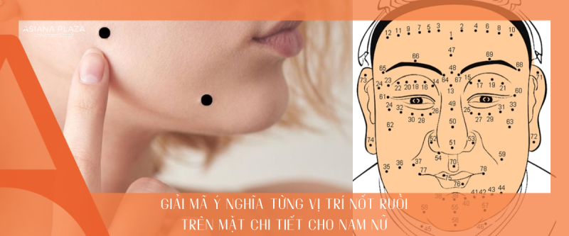Nốt ruồi trên mặt